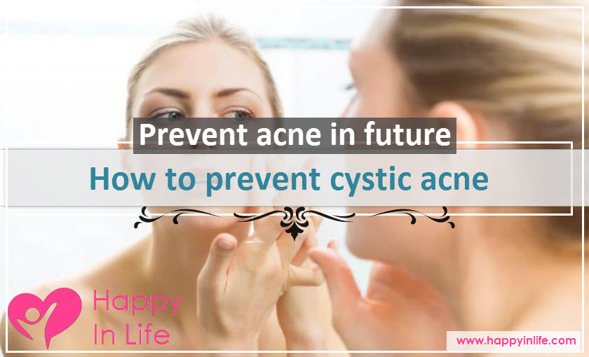 How to prevent cystic acne